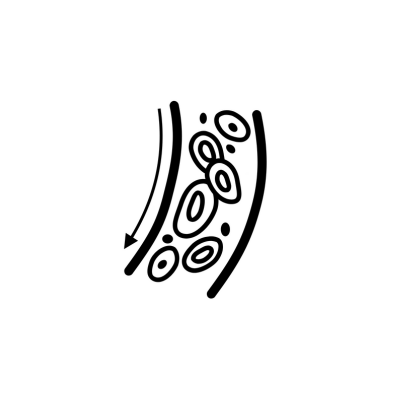 Troubles Circulatoires